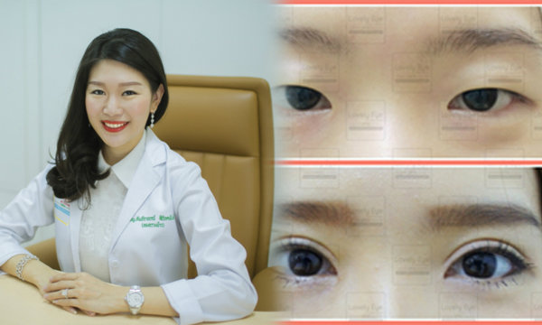 http://www.naadeng.com/eyelid-surgery/