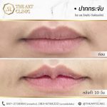 review-theartclinic-surgery-oral-01