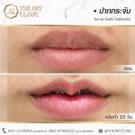 review-theartclinic-surgery-oral-05