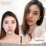 review-theartclinic-surgery-oral-08