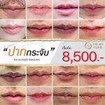 surgery-oral-a-01