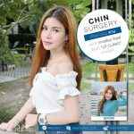 review-surgery-chin-lpclinic-02