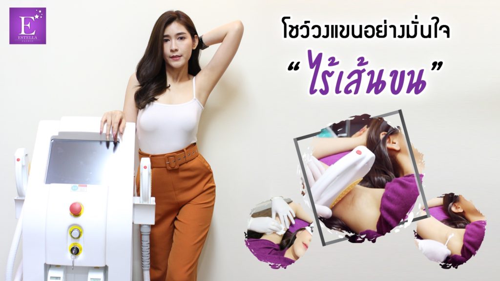 เอสเตลล่า คลินิก เลเซอร์กำจัดขน