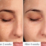 รีวิว EUCERIN UltraWhite+ Spotless Spot Corrector