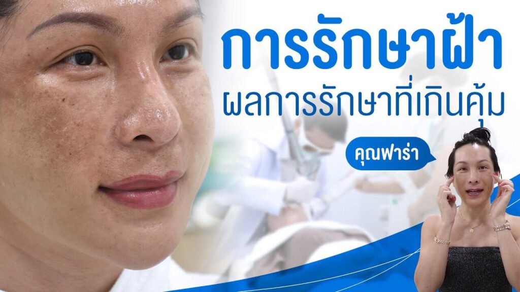 BSL Clinic คลินิกเลเซอร์รักษาฝ้ากระ